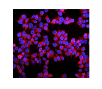 Stathmin 1/STMN1 Antibody