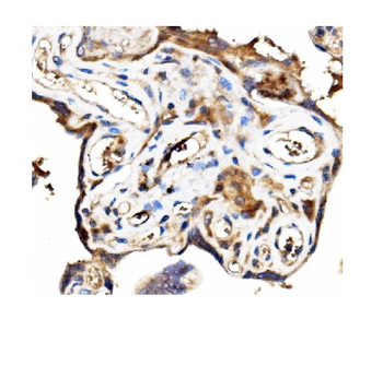 Stathmin 1/STMN1 Antibody