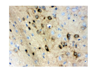 Stathmin 1/STMN1 Antibody