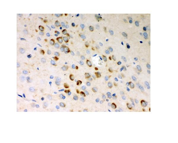Stathmin 1/STMN1 Antibody