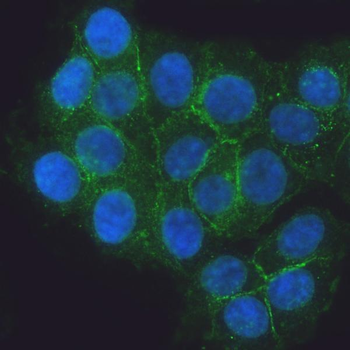 E Cadherin 1/CDH1 Antibody