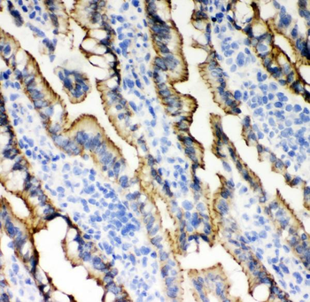 E Cadherin 1/CDH1 Antibody