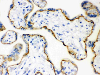 E Cadherin 1/CDH1 Antibody
