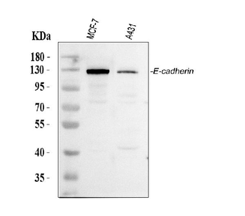 E Cadherin 1/CDH1 Antibody