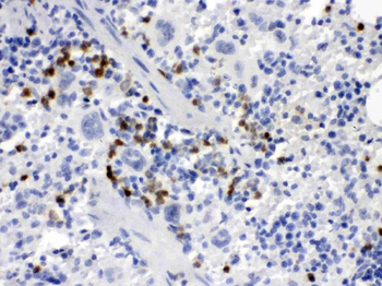 MCSF/CSF1 Rabbit Polyclonal Antibody