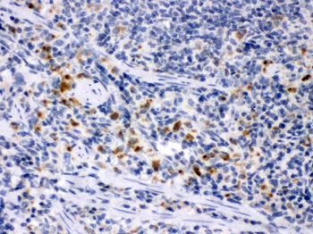 MCSF/CSF1 Rabbit Polyclonal Antibody