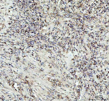 G-CSF/CSF3/CSF Rabbit Polyclonal Antibody