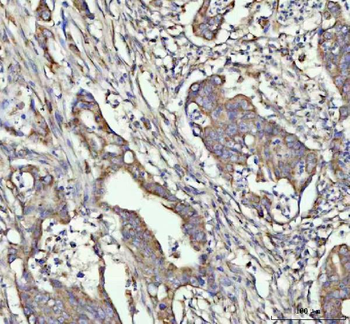 G-CSF/CSF3/CSF Rabbit Polyclonal Antibody
