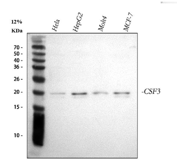 G-CSF/CSF3/CSF Rabbit Polyclonal Antibody