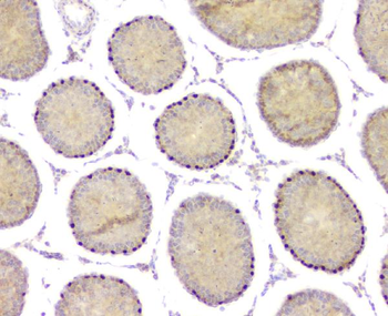 DMRT1 Rabbit Polyclonal Antibody