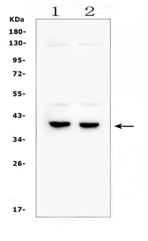 DMRT1 Rabbit Polyclonal Antibody