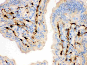 FABP4 Rabbit Polyclonal Antibody
