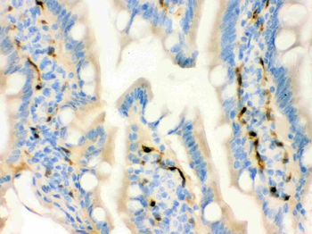 FABP4 Rabbit Polyclonal Antibody