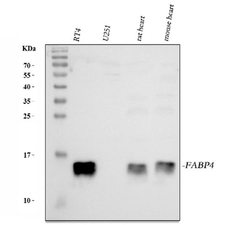 FABP4 Rabbit Polyclonal Antibody