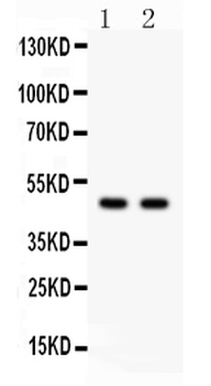 PTOV1 Rabbit Polyclonal Antibody