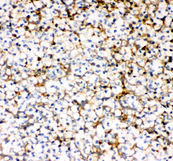 MCP1/CCL2 Rabbit Polyclonal Antibody