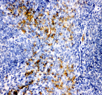 MCP1/CCL2 Rabbit Polyclonal Antibody