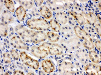 CRY2 Rabbit Polyclonal Antibody