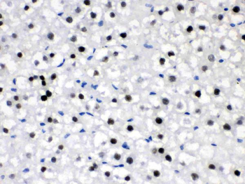 CRY2 Rabbit Polyclonal Antibody