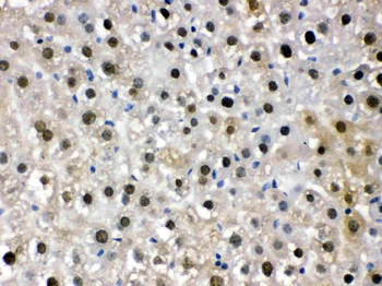 DDB1 Rabbit Polyclonal Antibody
