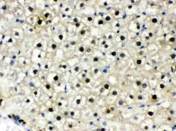 DDB1 Rabbit Polyclonal Antibody