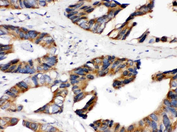 Lipoamide Dehydrogenase/DLD Rabbit Polyclonal Antibody