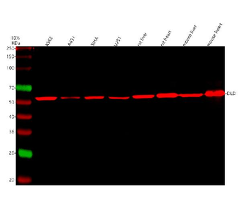 Lipoamide Dehydrogenase/DLD Rabbit Polyclonal Antibody