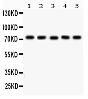 EED Rabbit Polyclonal Antibody