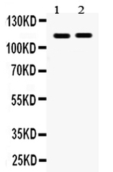 Eph receptor A5/EPHA5 Rabbit Polyclonal Antibody