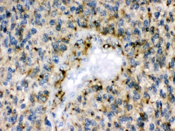 Eph receptor B1/EPHB1 Rabbit Polyclonal Antibody