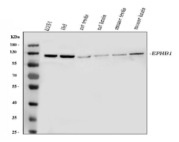 Eph receptor B1/EPHB1 Rabbit Polyclonal Antibody