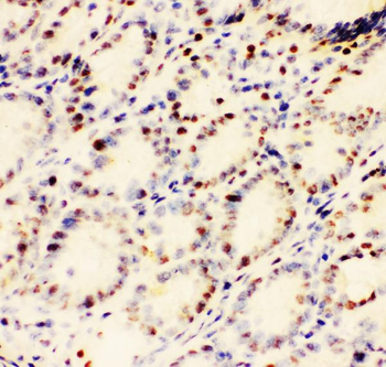 EWSR1 Rabbit Polyclonal Antibody
