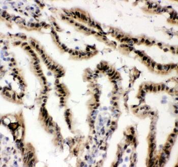 EWSR1 Rabbit Polyclonal Antibody