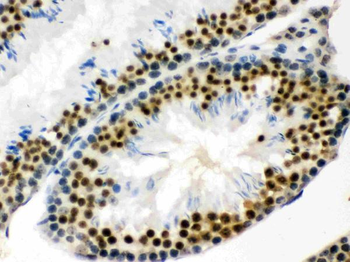 EWSR1 Rabbit Polyclonal Antibody