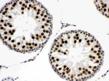 EWSR1 Rabbit Polyclonal Antibody