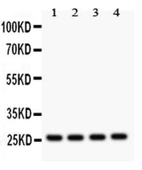 Flt3 ligand/FLT3LG Rabbit Polyclonal Antibody