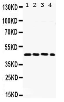 FRA2/FOSL2 Rabbit Polyclonal Antibody