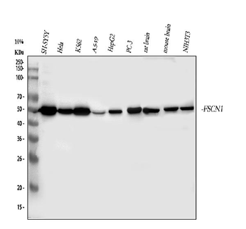 Fascin/FSCN1 Rabbit Polyclonal Antibody