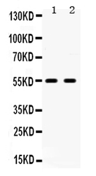 5HT2B Receptor/HTR2B Rabbit Polyclonal Antibody