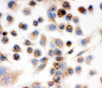IDH2 Antibody