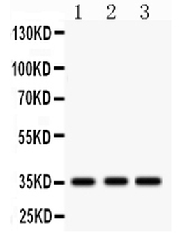 IGFBP2 Rabbit Polyclonal Antibody