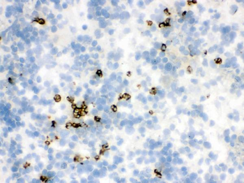 Lipocalin 2/LCN2 Antibody