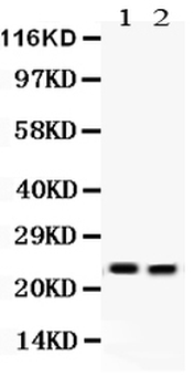 Lipocalin 2/LCN2 Antibody