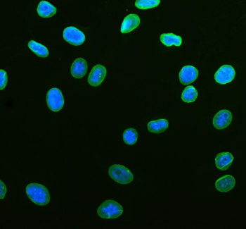 Lamin B1/LMNB1 Rabbit Polyclonal Antibody