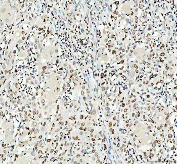 Lamin B1/LMNB1 Rabbit Polyclonal Antibody