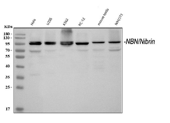 p95 NBS1/NBN Antibody