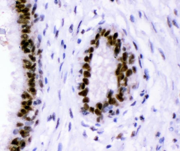 p95 NBS1/NBN Antibody