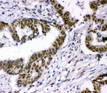 p95 NBS1/NBN Antibody