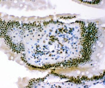 p95 NBS1/NBN Antibody