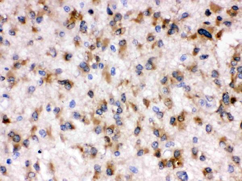 Otoferlin Rabbit Polyclonal Antibody